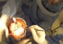 Knee Replacement Surgery