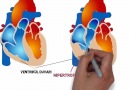 Kor Pulmonale - EKG ve Güncel Protokoller