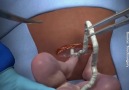 Medical Likes - Incredible Caesarean section Procedure Facebook