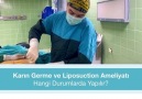 Merak EdilenlerKarın germe ve... - Op. Dr. Diren Çelik