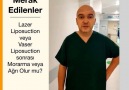 Merak EdilenlerLazer Liposuction... - Op. Dr. Diren Çelik