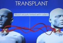 8 months until the worlds first human head transplant (Graphic).