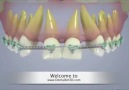 Multiple dentistry procedures explained using animations.
