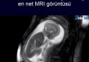 Net bir şekilde kaydedilmiş MRI görüntüsü