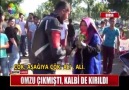 OMUZU ÇIKMIŞTI KALBİDE KIRILDI