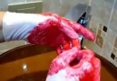 PDR Dr.Fatih Kalkinc - Doğru şekilde el nasıl yıkanmalı. Facebook