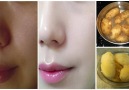 Permanent Skin Whitening