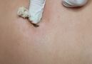 Popper Video - Huge Pop