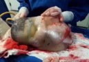 Rare moment a baby is born still inside the amniotic sac