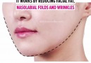Really Cool Things - Miracle V-Shaped Slimming Mask Facebook