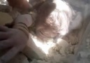 Rus bombardımanı küçük kızı vurdu