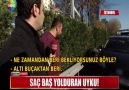 SAÇ BAŞ YOLDURAN UYKU!