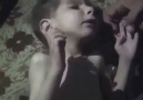 Şam/ Muaddamiye’de çocuklar açlıktan ölüyor.