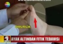 Show Ana Haber  Ayak Altından Fıtık Tedavisi