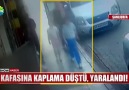 Show Ana Haber - KAFASINA KAPLAMA DÜŞTÜ YARALANDI! Facebook