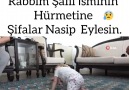 SİYAM İKİZLER 1 YAŞINDA