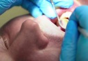 Stem Cell fillings allow teeth to heal themselves.