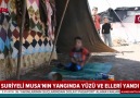 Suriyeli Musa tedavi olmayı bekliyor