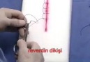 SÜTUR (DİKİŞ) ATMA TEKNİKLERİ www.selvet.com.tr