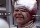 Syrian child breaks into smile after surviving Saturdays bus suicide bombing