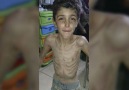 Syrian Town Starving to Death
