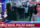 Tasması kopmuş bir it tarafından ısırılan polisimize geçmiş olsun )