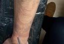 Tattoo JV Dövme Silme İşlemi 3.Seans İletişim 05327315051