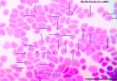 Theileriosis in cattle ( Sığırlarda Theileriosis )