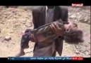 The Saudi genocide in Sadaa Yemen