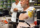These prosthetic limbs are controlled by your mind