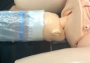 This device could save the life of a baby stuck in the birthing canal
