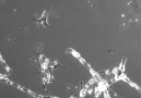 This is time lapse footage of neurons... - Emre Murat Varlık