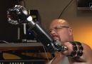 This Robotic Prosthetic Is Mind Controlled