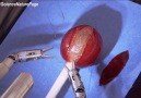 This robotic surgery is incredible. (Via Hashem Al-Ghaili)