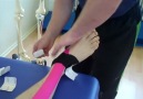 Tibialis Anterior Tendonopatiler için kinezyotape bantlama