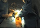 Total Knee Replacement Surgery