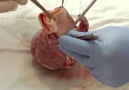 Türkçe Anlatımıyla Kalp Anatomisi (Gerçek)