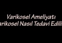 Varikosel AmeliyatıVarikosel Nasıl Tedavi EdilirRandevu 0532 565 88 34