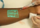 Vein Viewer Technology