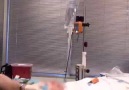 Video Larengeskop ile Endotrakial Entübasyon