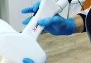 vilyaalieva - Yeni nesil epilasyon cihazı RobotX Hybrid...