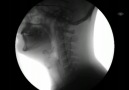 X-Ray Swallowing