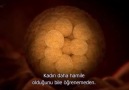 Yapışık İkizler(Siyam İkizleri)