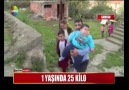 1 YAŞINDA 25 KİLO!