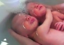 Yeni Doğan Bebeklere Su ile Terapi