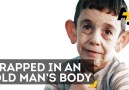 Young Boy Trapped in Old Man's Body
