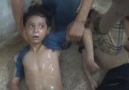 YÜREĞİ YETEN İZLESİN! Suriye'de yönetimin kimyasal silah kulla...