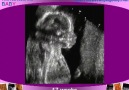 Baby Ultrasounds [HQ]