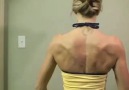 Damaged Long Thoracic Nerve - Winging Scapula -STETUSKOP.COM