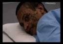 Discovery Channel  Ağaç Adam - Tedavi ░ Bölüm 3 / 4 ░